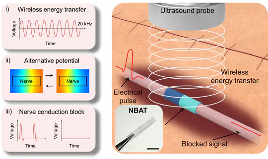 Wireless and bioresorbable triboelectric nerve block system for postoperative pain control