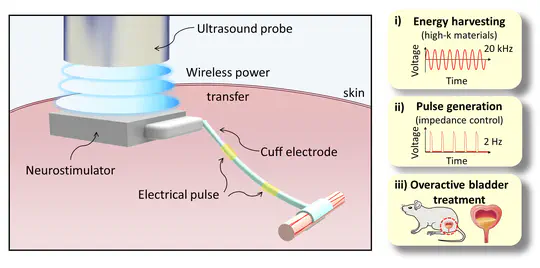 High-Performing and Capacitive-Matched Triboelectric Implants Driven by Ultrasound